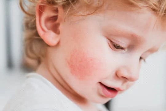Baby Skin Isn’t Just Smaller Adult Skin – Here’s Why That Matters