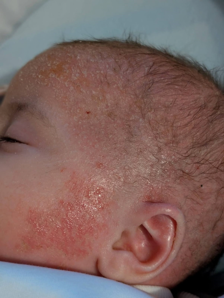 The Itch–Scratch Cycle: How Dry Skin Turns Into a Vicious Loop