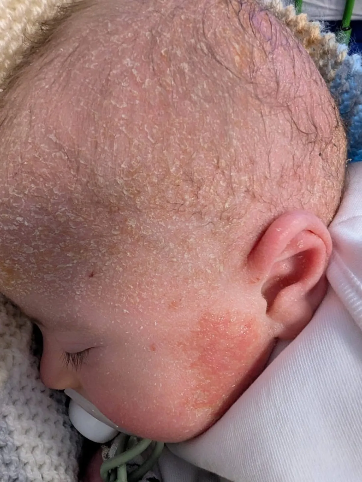 Toddler at bedtime for a parent guide about nighttime itching, scratching and eczema-prone skin