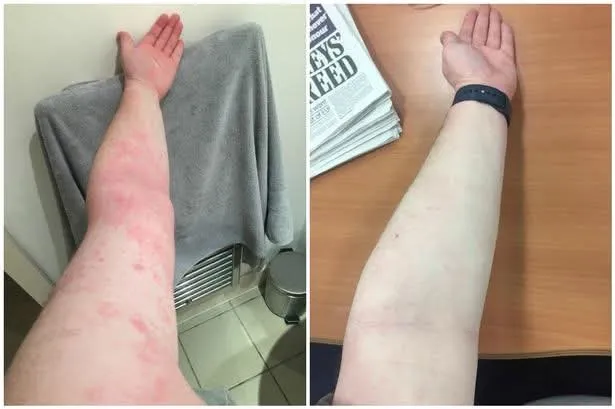 Baby rubbing and scratching face and head for a parent guide about eczema, itching, heat, saliva and irritated skin