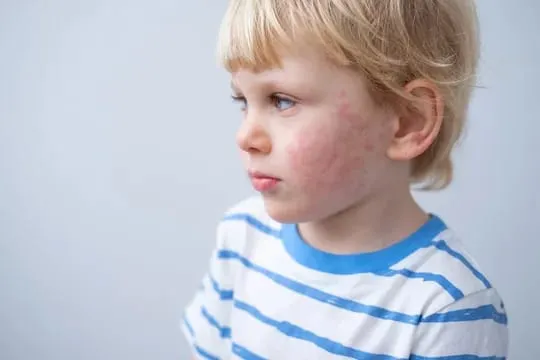 Baby at bedtime for a parent guide about nighttime itching, scratching and eczema-prone sensitive skin