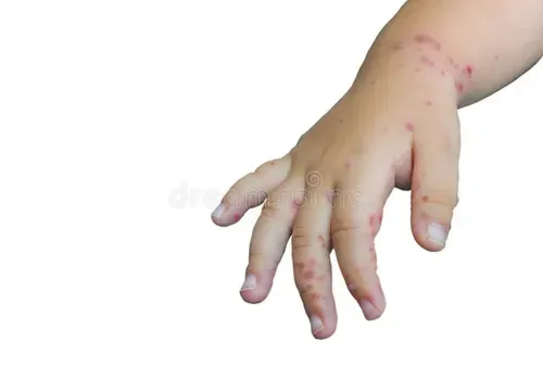 Baby skin for a parent guide about itching and scratching when there is no visible rash